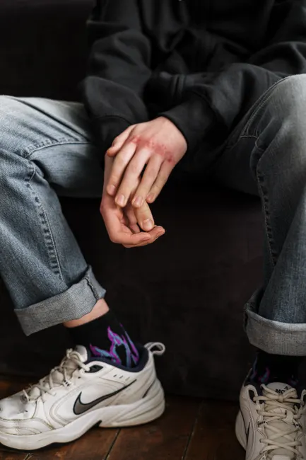 A teenager's folded hands showing injuries, wearing casual jeans and sneakers, sitting indoors.